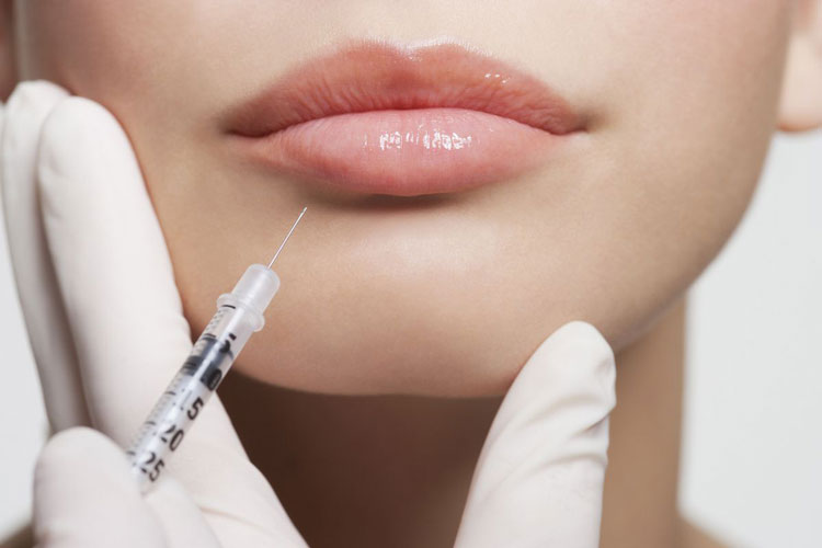 Lip-augmentation