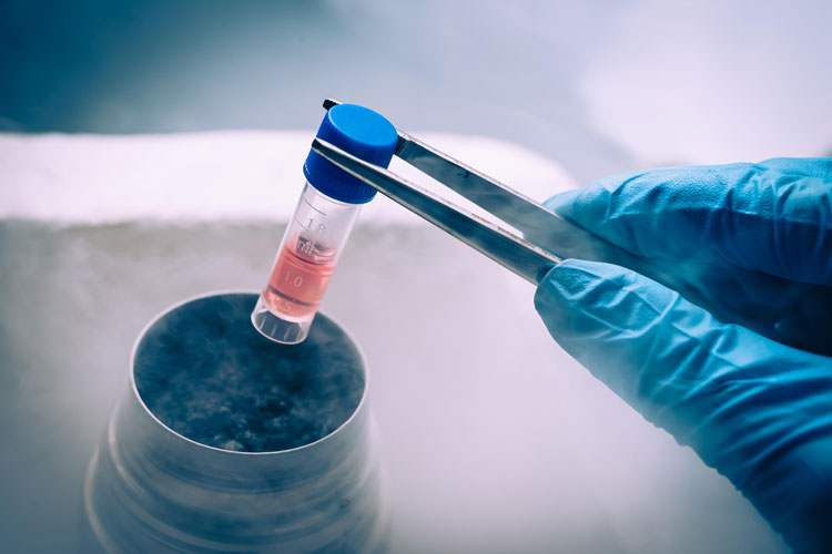Stem_Cells